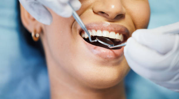 Best Emergency Dental Care for Broken or Chipped Teeth in Picayune, MS
